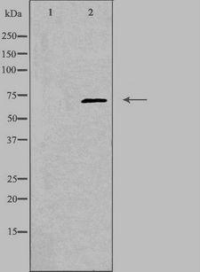 TROVE2 Antibody - Western blot analysis of extracts of A549 cells using TROVE2 antibody. The lane on the left is treated with the antigen-specific peptide.