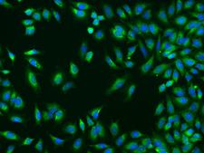 TROVE2 Antibody - Immunofluorescence staining of TROVE2 in HeLa cells. Cells were fixed with 4% PFA, permeabilzed with 0.1% Triton X-100 in PBS, blocked with 10% serum, and incubated with rabbit anti-Human TROVE2 polyclonal antibody (dilution ratio 1:200) at 4°C overnight. Then cells were stained with the Alexa Fluor 488-conjugated Goat Anti-rabbit IgG secondary antibody (green) and counterstained with DAPI (blue). Positive staining was localized to Cytoplasm.
