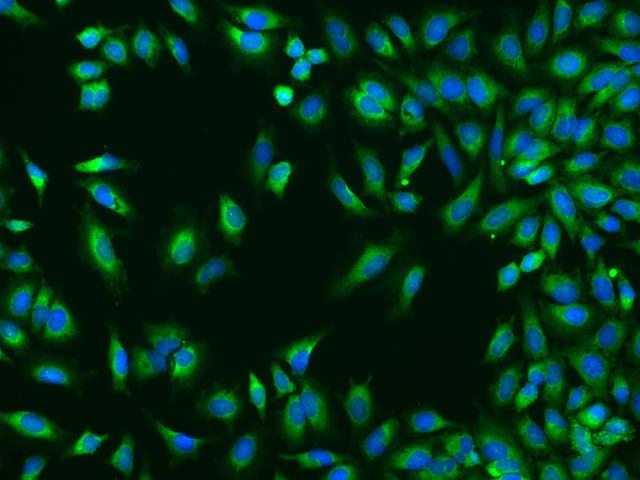 TROVE2 Antibody - Immunofluorescence staining of TROVE2 in HeLa cells. Cells were fixed with 4% PFA, permeabilzed with 0.1% Triton X-100 in PBS, blocked with 10% serum, and incubated with rabbit anti-Human TROVE2 polyclonal antibody (dilution ratio 1:200) at 4°C overnight. Then cells were stained with the Alexa Fluor 488-conjugated Goat Anti-rabbit IgG secondary antibody (green) and counterstained with DAPI (blue). Positive staining was localized to Cytoplasm.