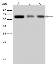 TROVE2 Antibody - Anti-TROVE2 rabbit polyclonal antibody at 1:500 dilution. Lane A: Jurkat Whole Cell Lysate. Lane B: A431 Whole Cell Lysate. Lane C: HepG2 Whole Cell Lysate. Lysates/proteins at 30 ug per lane. Secondary: Goat Anti-Rabbit IgG (H+L)/HRP at 1/10000 dilution. Developed using the ECL technique. Performed under reducing conditions. Predicted band size: 61 kDa. Observed band size: 61 kDa.