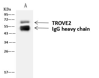 TROVE2 Antibody - TROVE2 was immunoprecipitated using: Lane A: 0.5 mg Jurkat Whole Cell Lysate. 4 uL anti-TROVE2 rabbit polyclonal antibody and 60 ug of Immunomagnetic beads Protein A/G. Primary antibody: Anti-TROVE2 rabbit polyclonal antibody, at 1:100 dilution. Secondary antibody: Goat Anti-Rabbit IgG (H+L)/HRP at 1/10000 dilution. Developed using the ECL technique. Performed under reducing conditions. Predicted band size: 61 kDa. Observed band size: 61 kDa.