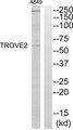TROVE2 Antibody - Western blot analysis of extracts from A549 cells, using TROVE2 antibody.