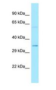 TRP32 / TXNL1 Antibody - TRP32 / TXNL1 antibody Western Blot of Fetal Lung.  This image was taken for the unconjugated form of this product. Other forms have not been tested.