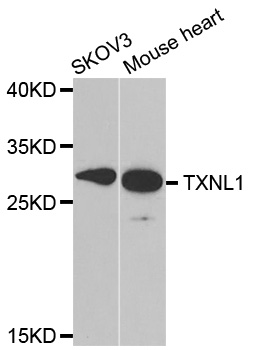 TRP32 / TXNL1 Antibody - Western blot analysis of extracts of various cell lines.