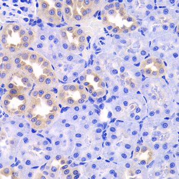 TRP32 / TXNL1 Antibody - Immunohistochemistry of paraffin-embedded rat kidney tissue.