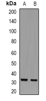 TRP32 / TXNL1 Antibody - Western blot analysis of TXNL1 expression in SKOV3 (A); mouse heart (B) whole cell lysates.
