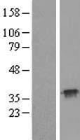 TRP32 / TXNL1 Protein - Western validation with an anti-DDK antibody * L: Control HEK293 lysate R: Over-expression lysate