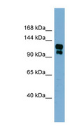 TRPA1 Antibody - TRPA1 antibody Western blot of Fetal Stomach lysate. This image was taken for the unconjugated form of this product. Other forms have not been tested.