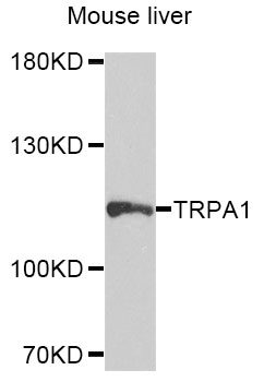 TRPA1 Antibody - Western blot analysis of extracts of Mouse liver cells.