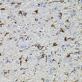TRPA1 Antibody - Immunohistochemistry of paraffin-embedded rat brain tissue.