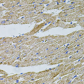 TRPA1 Antibody - Immunohistochemistry of paraffin-embedded rat heart tissue.