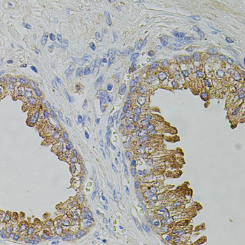 TRPA1 Antibody - Immunohistochemistry of paraffin-embedded human prostate tissue.