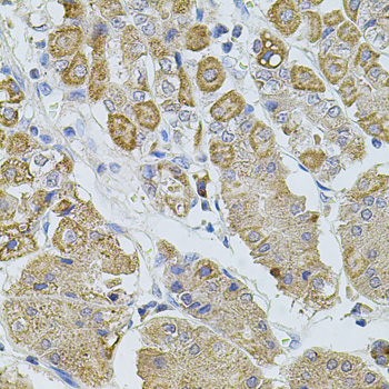 TRPA1 Antibody - Immunohistochemistry of paraffin-embedded human stomach tissue.