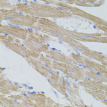 TRPA1 Antibody - Immunohistochemistry of paraffin-embedded mouse heart tissue.