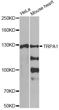 TRPA1 Antibody - Western blot analysis of extracts of various cell lines, using TRPA1 antibody at 1:1000 dilution. The secondary antibody used was an HRP Goat Anti-Rabbit IgG (H+L) at 1:10000 dilution. Lysates were loaded 25ug per lane and 3% nonfat dry milk in TBST was used for blocking. An ECL Kit was used for detection and the exposure time was 90s.