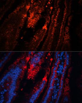 TRPA1 Antibody - Immunofluorescence analysis of Mouse intestine using TRPA1 Polyclonal Antibody at dilution of 1:100.Blue: DAPI for nuclear staining.