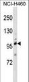 TRPC1 Antibody - TRPC1 Antibody western blot of NCI-H460 cell line lysates (35 ug/lane). The TRPC1 antibody detected the TRPC1 protein (arrow).