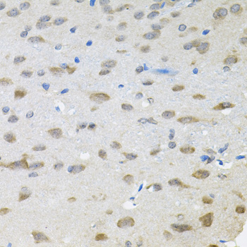 TRPC1 Antibody - Immunohistochemistry of paraffin-embedded rat brain tissue.