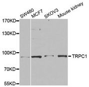 TRPC1 Antibody - Western blot analysis of extracts of various cell lines, using TRPC1 antibody at 1:1000 dilution. The secondary antibody used was an HRP Goat Anti-Rabbit IgG (H+L) at 1:10000 dilution. Lysates were loaded 25ug per lane and 3% nonfat dry milk in TBST was used for blocking. An ECL Kit was used for detection and the exposure time was 1s.