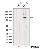 TRPC1 Antibody - Western blot analysis of extracts of 3T3 cells using TRPC1 antibody. The lane on the left was treated with blocking peptide.