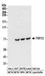 TRPC3 Antibody - Detection of Human TRPC3 by Western Blot. Samples: Whole cell lysate (50 ug) prepared using NETN or RIPA buffer from HeLa, 293T, and Jurkat cells. Antibodies: Affinity purified rabbit anti-TRPC3 antibody used for WB at 0.1 ug/ml. Detection: Chemiluminescence with an exposure time of 3 minutes.