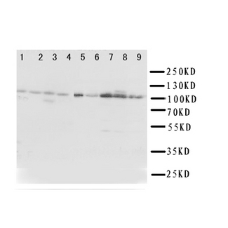 TRPC3 Antibody - WB of TRPC3 antibody. Lane 1: Rat Liver Tissue Lysate. Lane 2: Rat Lung Tissue Lysate. Lane 3: Rat Intestine Tissue Lysate. Lane 4: Rat Ovary Tissue Lysate. Lane 5: U87 Cell Lysate. Lane 6: A549 Cell Lysate. Lane 7: COLO320 Cell Lysate. Lane 8: SW620 Cell Lysate. Lane 9: HELA Cell Lysate.