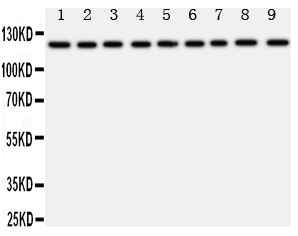 TRPC3 Antibody - Anti-TRPC3 antibody, Western blotting All lanes: Anti TRPC3 at 0.5ug/ml Lane 1: Rat Liver Tissue Lysate at 50ugLane 2: Rat Lung Tissue Lysate at 50ugLane 3: Rat Intestine Tissue Lysate at 50ugLane 4: Rat Ovary Tissue Lysate at 50ugLane 5: U87 Whole Cell Lysate at 40ugLane 6: A549 Whole Cell Lysate at 40ugLane 7: COLO320 Whole Cell Lysate at 40ugLane 8: SW620 Whole Cell Lysate at 40ugLane 9: HELA Whole Cell Lysate at 40ugPredicted bind size: 97KD Observed bind size: 120KD