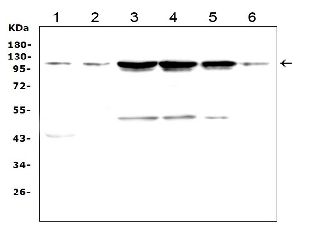 TRPC3 Antibody - Western blot analysis of TRPC3 using anti-TRPC3 antibody. Electrophoresis was performed on a 5-20% SDS-PAGE gel at 70V (Stacking gel) / 90V (Resolving gel) for 2-3 hours. The sample well of each lane was loaded with 50ug of sample under reducing conditions. Lane 1: rat brain tissue lysates, Lane 2: mouse brain tissue lysates, Lane 3: human Hela whole cell lysates, Lane 4: human 22RV1 whole cell lysates, Lane 5: human U-87MG whole cell lysates, Lane 6: mouse Neuro-2a whole cell lysates, After Electrophoresis, proteins were transferred to a Nitrocellulose membrane at 150mA for 50-90 minutes. Blocked the membrane with 5% Non-fat Milk/ TBS for 1.5 hour at RT. The membrane was incubated with rabbit anti-TRPC3 antigen affinity purified polyclonal antibody at 0.5 µg/mL overnight at 4°C, then washed with TBS-0.1% Tween 3 times with 5 minutes each and probed with a goat anti-rabbit IgG-HRP secondary antibody at a dilution of 1:10000 for 1.5 hour at RT. The signal is developed using an Enhanced Chemiluminescent detection (ECL) kit with Tanon 5200 system. A specific band was detected for TRPC3 at approximately 110KD. The expected band size for TRPC3 is at 93KD.