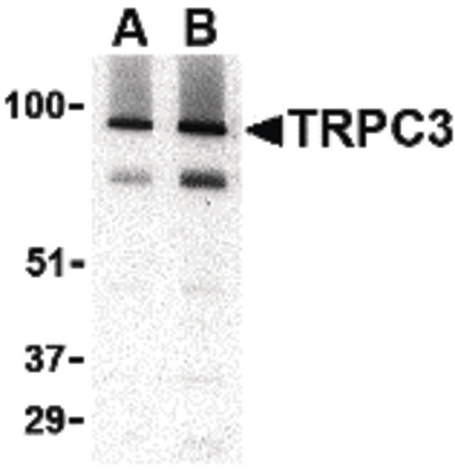 TRPC3 Antibody - Western blot of TRPC3 in human brain tissue lysate with TRPC3 antibody at (A) 1 and (B) 2 ug/ml.