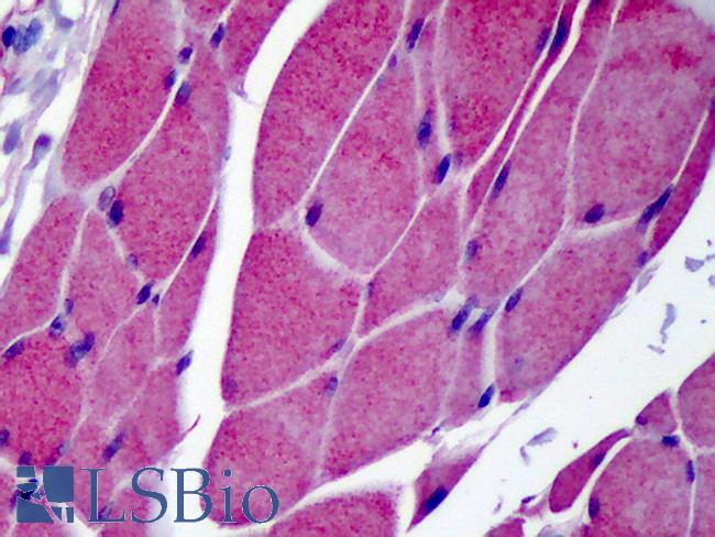 TRPC3 Antibody - Anti-TRPC3 antibody IHC of human skeletal muscle. Immunohistochemistry of formalin-fixed, paraffin-embedded tissue after heat-induced antigen retrieval. Antibody concentration 5 ug/ml.