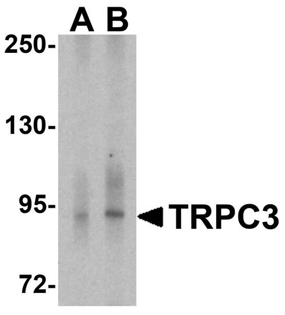TRPC3 Antibody - Western blot analysis of TRPC3 in human cerebellum tissue lysate with TRPC3 antibody at (A) 1 and (B) 2 ug/ml.