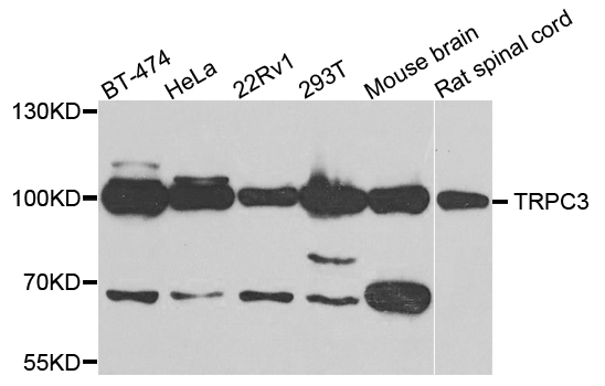 TRPC3 Antibody - Western blot analysis of extracts of various cells.