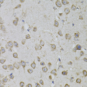 TRPC3 Antibody - Immunohistochemistry of paraffin-embedded mouse brain tissue.
