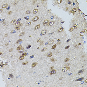 TRPC3 Antibody - Immunohistochemistry of paraffin-embedded rat brain tissue.