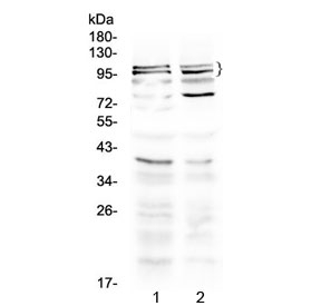 TRPC3 Antibody - Western blot testing of 1) rat brain and 2) mouse brain lysate with TRPC3 antibody at 0.5ug/ml. Predicted molecular weight ~96/106/97 kDa (isoforms 1/2/3).