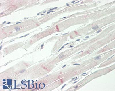 TRPC3 Antibody - Human Heart: Formalin-Fixed, Paraffin-Embedded (FFPE).  This image was taken for the unconjugated form of this product. Other forms have not been tested.