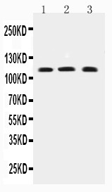 TRPC4 Antibody - WB of TRPC4 antibody. All lanes: Anti-TRPC4 at 0.5ug/ml. Lane 1: COLO320 Whole Cell Lysate at 40ug. Lane 2: MCF-7 Whole Cell Lysate at 40ug. Lane 3: PANC Whole Cell Lysate at 40ug. Predicted bind size: 112KD. Observed bind size: 112KD.