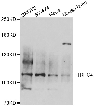 TRPC4 Antibody - Western blot analysis of extracts of various cell lines.