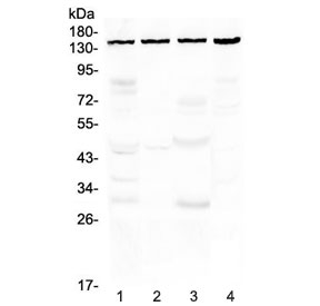 TRPC4 Antibody - Western blot testing of human 1) HeLa, 2) COLO320, 3) MCF7 and 4) 293T cell lysate with TRPC4 antibody at 0.5ug/ml. Predicted molecular weight ~112 kDa, observed here at ~150 kDa.