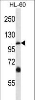 TRPC5 Antibody - TRPC5 Antibody western blot of HL-60 cell line lysates (35 ug/lane). The TRPC5 antibody detected the TRPC5 protein (arrow).