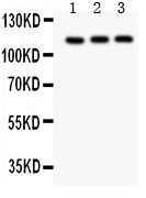 TRPC5 Antibody - TRPC5 antibody Western blot. All lanes: Anti TRPC5 at 0.5 ug/ml. Lane 1: HELA Whole Cell Lysate at 40 ug. Lane 2: U87 Whole Cell Lysate at 40 ug. Lane 3: COLO320 Whole Cell Lysate at 40 ug. Predicted band size: 111 kD. Observed band size: 111 kD.