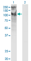 TRPC5 Antibody - Western Blot analysis of TRPC5 expression in transfected 293T cell line by TRPC5 monoclonal antibody (M10), clone 1C8.Lane 1: TRPC5 transfected lysate (Predicted MW: 111.4 KDa).Lane 2: Non-transfected lysate.