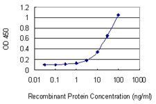 TRPC5 Antibody - Detection limit for recombinant GST tagged TRPC5 is 1 ng/ml as a capture antibody.
