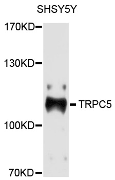 TRPC5 Antibody - Western blot analysis of extracts of SHSY5Y cells.