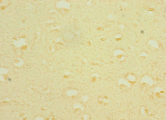 TRPC5 Antibody - Immunohistochemistry of paraffin-embedded human brain tissue at dilution 1:100
