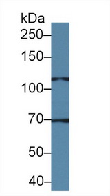 TRPC6 Antibody - Western Blot; Sample: Porcine Cerebrum lysate; Primary Ab: 2µg/ml Rabbit Anti-Human TRPC6 Antibody Second Ab: 0.2µg/mL HRP-Linked Caprine Anti-Rabbit IgG Polyclonal Antibody