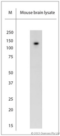 TRPC6 Antibody - Rabbit antibody to TRPC6 (10-60). WB on mouse brain lysate. Blocking: 1% LFDM for 30 min at RT; primary antibody: dilution 5 ug/ml incubated at 4C overnight.
