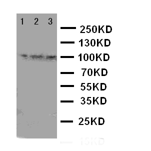 TRPC6 Antibody - WB of TRPC6 antibody. Lane 1: Rat Lung Tissue Lysate. Lane 2: 293T Cell Lysate. Lane 3: 293T Cell Lysate..