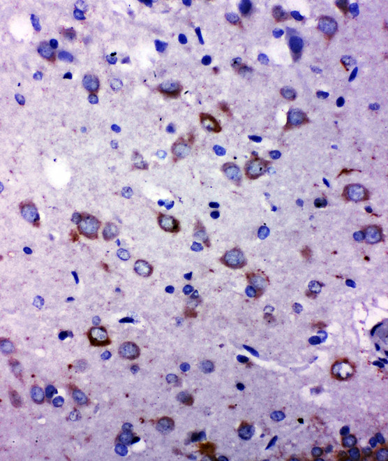 TRPC6 Antibody - TRPC6 antibody. IHC(P): Rat Brain Tissue.