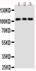 TRPC6 Antibody - Western blot analysis of TRPC6 using anti-TRPC6 antibody. Electrophoresis was performed on a 5-20% SDS-PAGE gel at 70V (Stacking gel) / 90V (Resolving gel) for 2-3 hours. The sample well of each lane was loaded with 50ug of sample under reducing conditions. Lane 1: Rat Lung Tissue Lysate Lane 2: 293T Cell Lysate Lane 3: 293T Cell Lysate After Electrophoresis, proteins were transferred to a Nitrocellulose membrane at 150mA for 50-90 minutes. Blocked the membrane with 5% Non-fat Milk/ TBS for 1.5 hour at RT. The membrane was incubated with rabbit anti-TRPC6 antigen affinity purified polyclonal antibody at 0.5 µg/mL overnight at 4°C, then washed with TBS-0.1% Tween 3 times with 5 minutes each and probed with a goat anti-rabbit IgG-HRP secondary antibody at a dilution of 1:10000 for 1.5 hour at RT. The signal is developed using an Enhanced Chemiluminescent detection (ECL) kit with Tanon 5200 system. A specific band was detected for TRPC6 at approximately 106-120KD. The expected band size for TRPC6 is at 106KD.